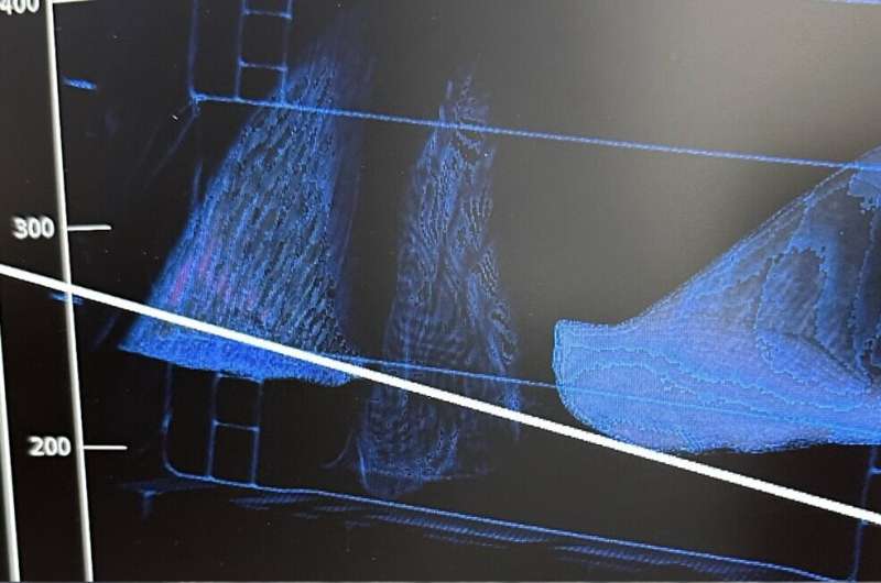 AI 算法助力打击海洋野生动物走私,识别准确率达 92%